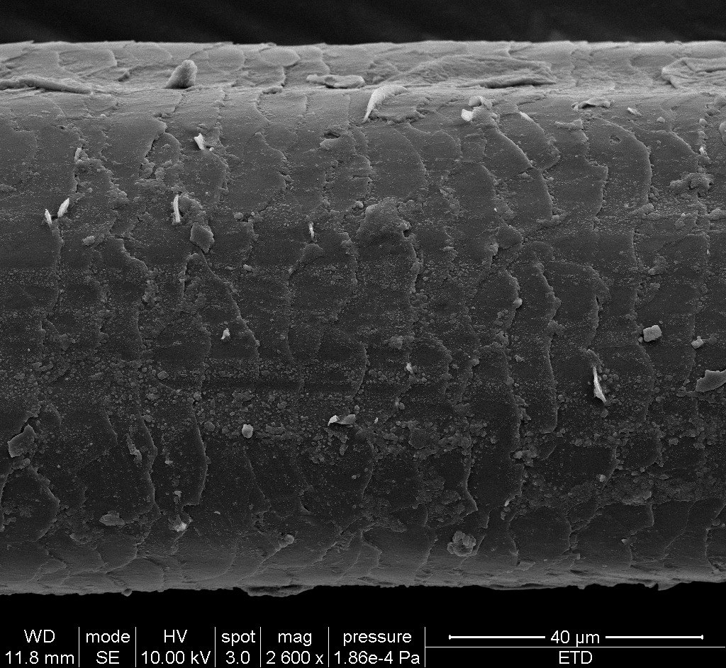 Hair strand through SEM - 1