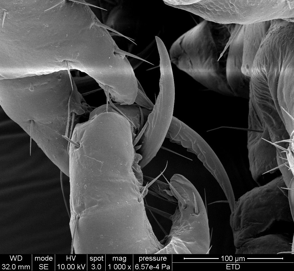 Louse through SEM - 17